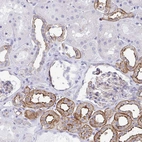 Immunohistochemical staining of human kidney shows strong membranous positivity in cells in tubules.