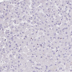 Anti-DBN1 Antibody