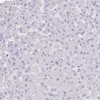 Immunohistochemical staining of human liver shows no positivity in hepatocytes as expected.