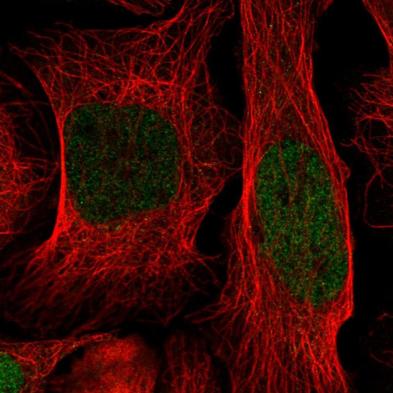Anti-ID1 Antibody