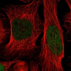Anti-ID1 Antibody