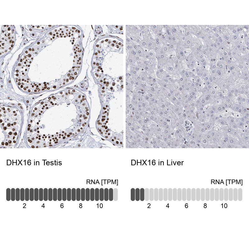 Anti-DHX16 Antibody