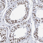 Immunohistochemical staining of human testis shows high expression.