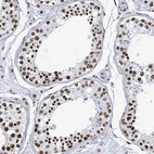 Immunohistochemical staining of human testis shows high expression.