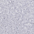 Immunohistochemical staining of human liver shows low expression as expected.