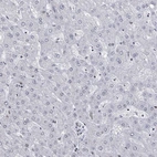 Immunohistochemical staining of human liver shows low expression as expected.