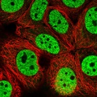 Immunofluorescent staining of human cell line MCF7 shows localization to nucleoplasm.