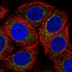 Immunofluorescent staining of human cell line MCF7 shows localization to mitochondria.