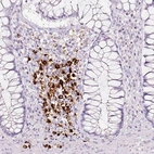 Immunohistochemical staining of human gastrointestinal shows strong cytoplasmic positivity in lymphoid cells.