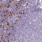 Immunohistochemical staining of human lymphoid tissues shows strong cytoplasmic positivity in non-germinal center cells.