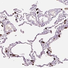 Immunohistochemical staining of human lung shows strong cytoplasmic positivity in macrophages.