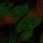 Immunofluorescent staining of human cell line HUVEC TERT2 shows localization to nucleoplasm, cytosol & cytoplasmic bodies.
