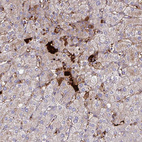 Immunohistochemical staining of human liver shows strong cytoplasmic positivity in hepatocytes.
