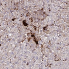 Immunohistochemical staining of human liver shows strong cytoplasmic positivity in hepatocytes.
