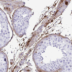 Immunohistochemical staining of human testis shows moderate cytoplasmic positivity in peritubular myeloid cells in seminiferous ducts and Leydig cells.