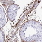 Immunohistochemical staining of human testis shows moderate cytoplasmic positivity in peritubular myeloid cells in seminiferous ducts and Leydig cells.