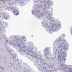 Immunohistochemical staining of human prostate shows negative cytoplasmic positivity in glandular cells as expected.