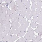 Immunohistochemical staining of human skeletal muscle shows negative cytoplasmic positivity in myocytes as expected.