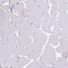 Immunohistochemical staining of human skeletal muscle shows negative cytoplasmic positivity in myocytes as expected.