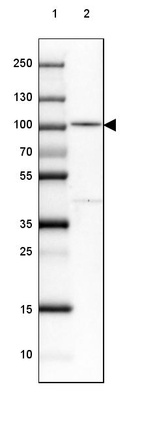 Lane 1: Marker [kDa] 250, 130, 100, 70, 55, 35, 25, 15, 10_br/_Lane 2: Human cell line EFO-21