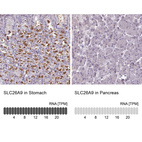 Anti-SLC26A9 Antibody