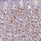 Immunohistochemical staining of human stomach shows high expression.