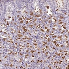 Anti-SLC26A9 Antibody