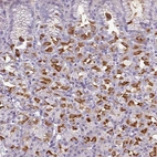 Immunohistochemical staining of human stomach shows high expression.