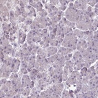 Anti-SLC26A9 Antibody