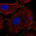 Immunofluorescent staining of human cell line A549 shows localization to cell junctions.