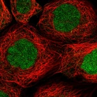 Immunofluorescent staining of human cell line A-431 shows localization to nucleoplasm.