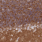 Anti-NPTN Antibody