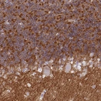 Anti-NPTN Antibody