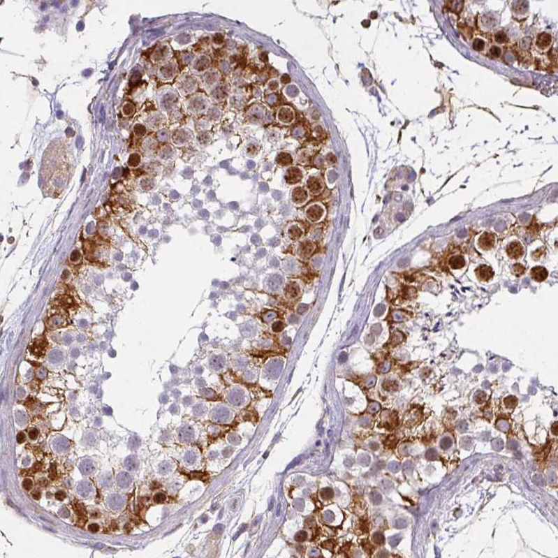 Anti-ZNF280C Antibody