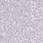 Immunohistochemical staining of human liver shows no positivity in hepatocytes as expected.