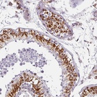 Anti-ZNF280C Antibody