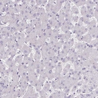 Immunohistochemical staining of human liver shows no positivity in hepatocytes as expected.