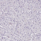Anti-ZNF280C Antibody