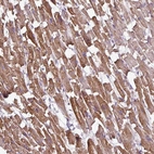 Immunohistochemical staining of human Heart muscle shows moderate membranous positivity in cardiomyocytes.