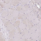 Immunohistochemical staining of human Skeletal muscle shows no membranous positivity in myocytes.