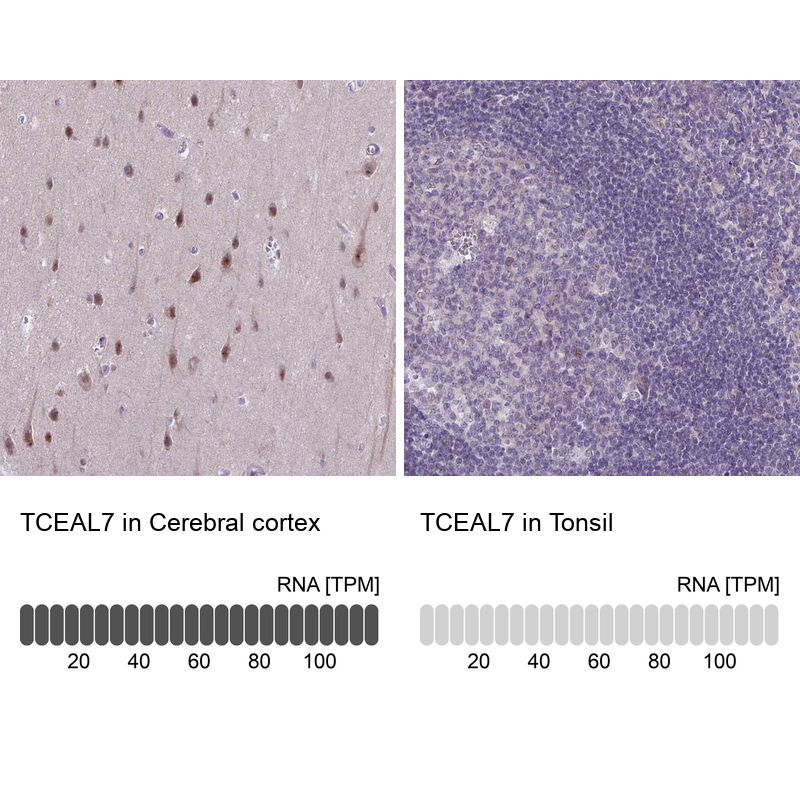Anti-TCEAL7 Antibody
