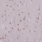 Immunohistochemical staining of human cerebral cortex shows high expression.