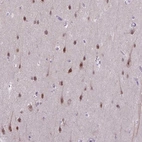Immunohistochemical staining of human cerebral cortex shows high expression.