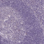 Immunohistochemical staining of human tonsil shows low expression as expected.