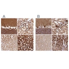 Anti-MT-CO2 Antibody