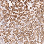 Immunohistochemical staining of human liver shows moderate granular cytoplasmic positivity in hepatocytes.