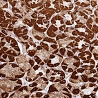 Immunohistochemical staining of human stomach shows strong granular cytoplasmic positivity in parietal cells.