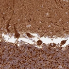 Immunohistochemical staining of human cerebellum shows strong granular cytoplasmic positivity in Purkinje cells.