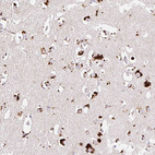 Anti-CLEC3A Antibody