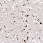 Anti-CLEC3A Antibody